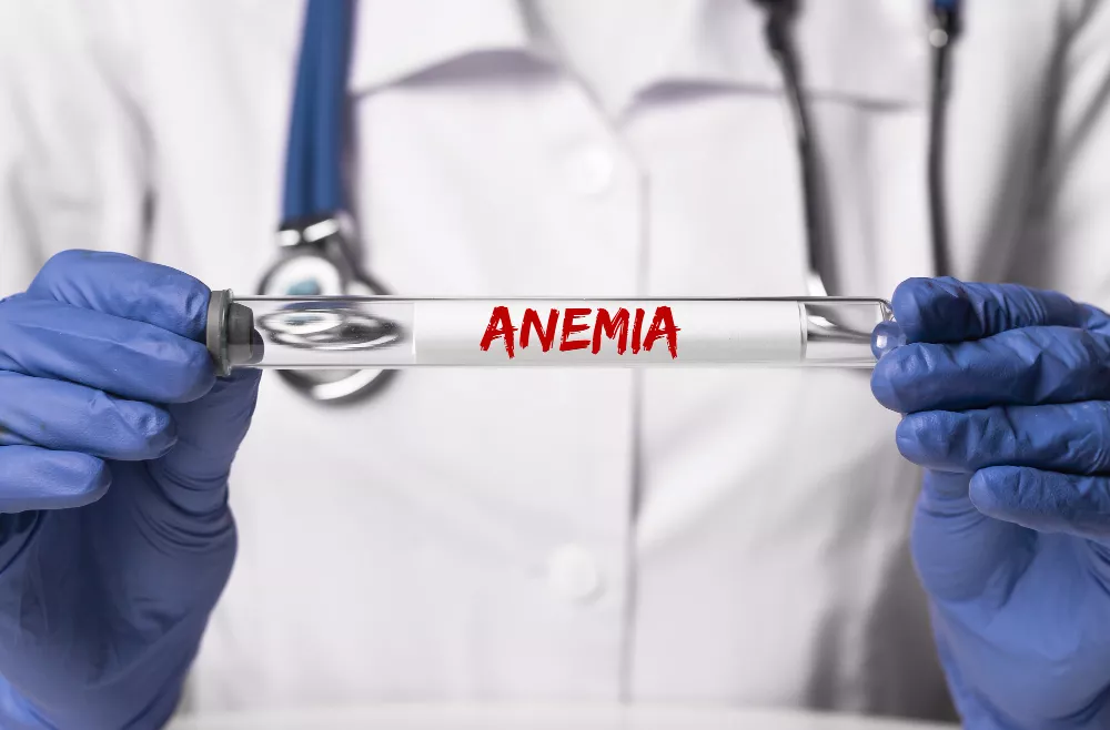 Anemia